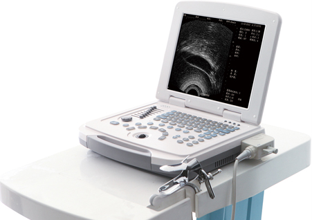 超導(dǎo)可視無痛人流機(jī),可視無痛人流機(jī),可視人流機(jī),可視人流b超機(jī),