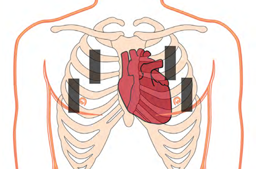 床旁超聲能檢查肺部嗎？